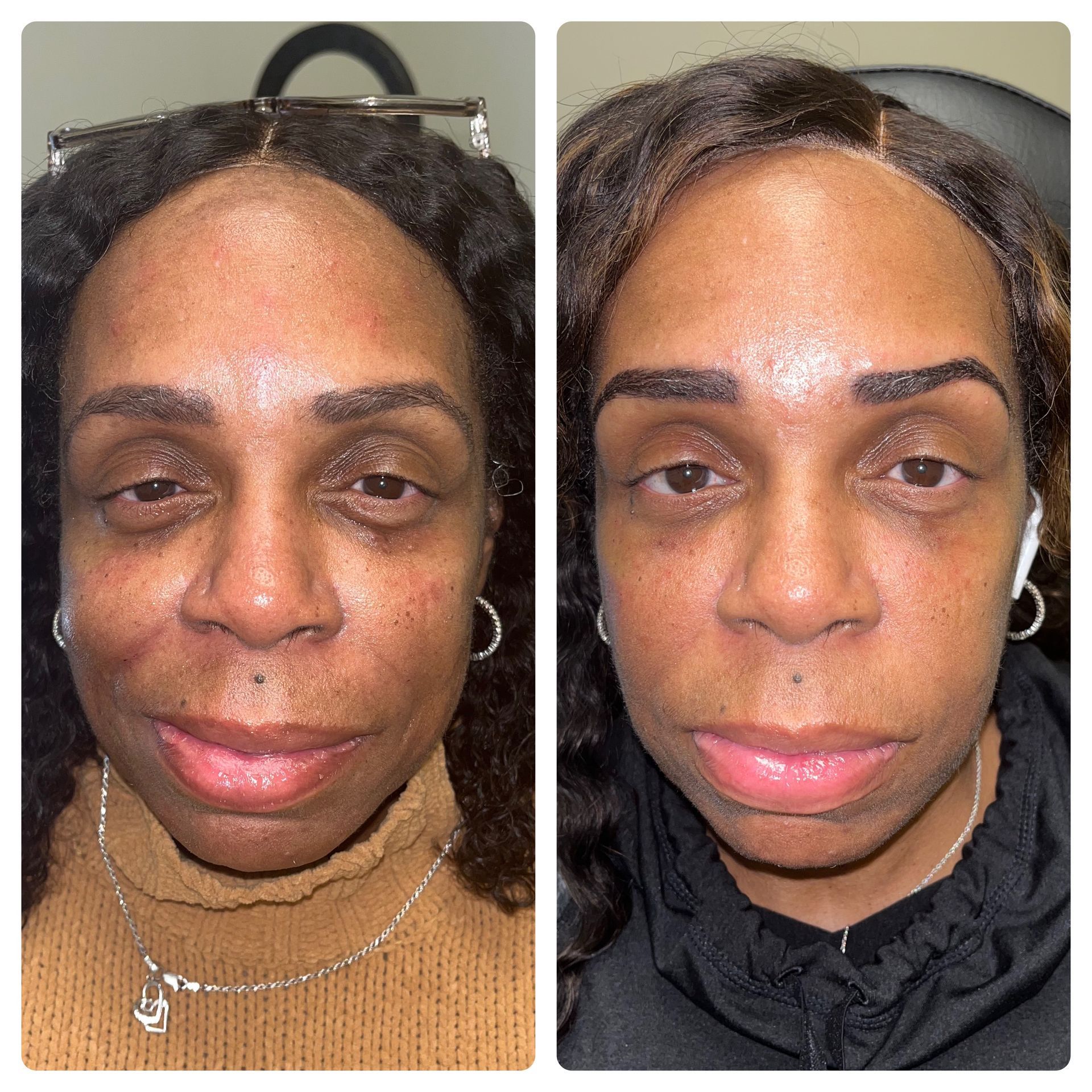 A before and after photo of a woman 's face