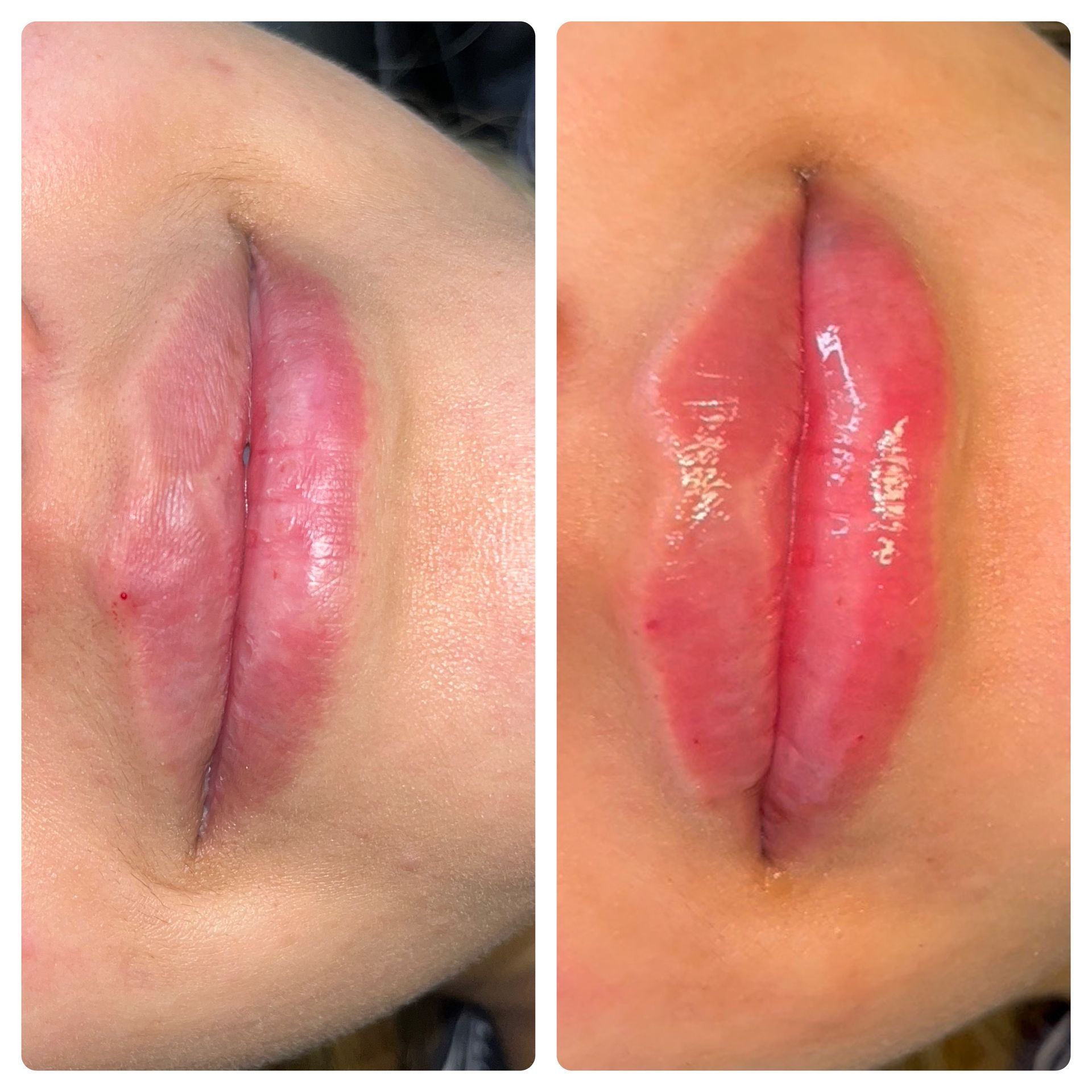 A before and after photo of a woman 's lips.