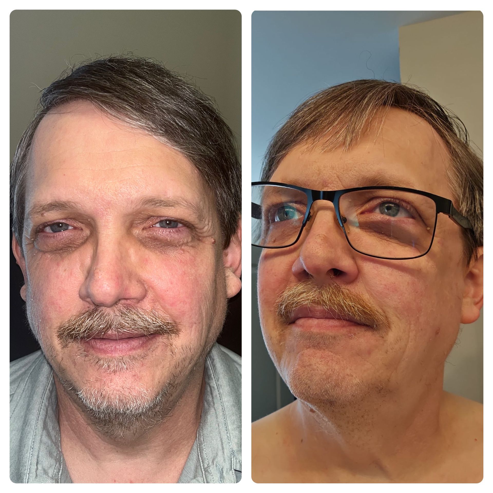 Two pictures of a man with glasses and a mustache.