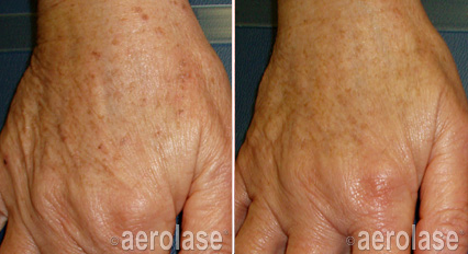 A before and after photo of a person 's hands.