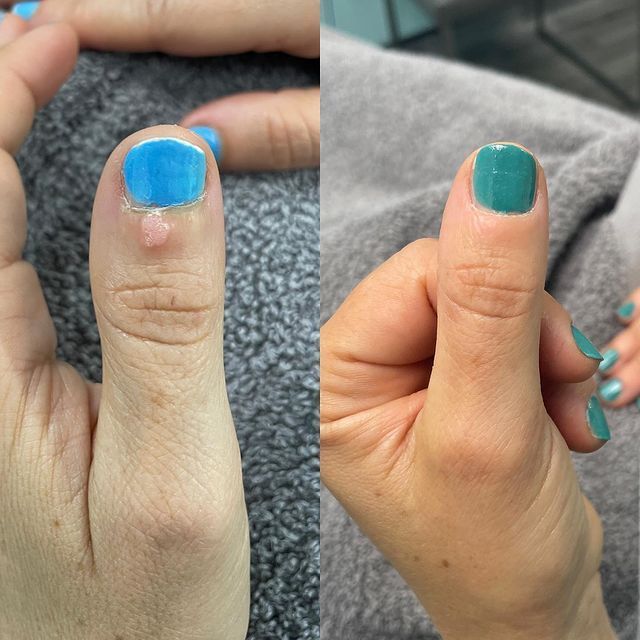 A before and after photo of a person 's nails