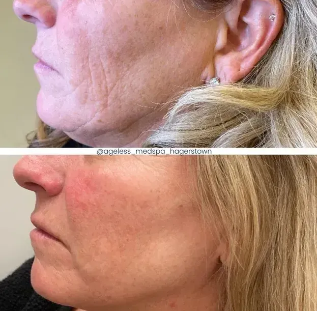 A before and after photo of a woman 's face