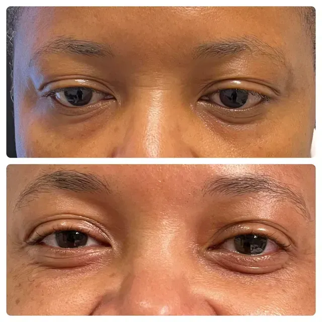 A before and after photo of a woman 's eyes