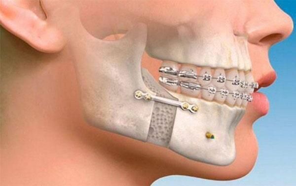 DRA. DORA ALICIA RAMÍREZ CASTRO - CIRUGÍA ORTOGNÁTICA