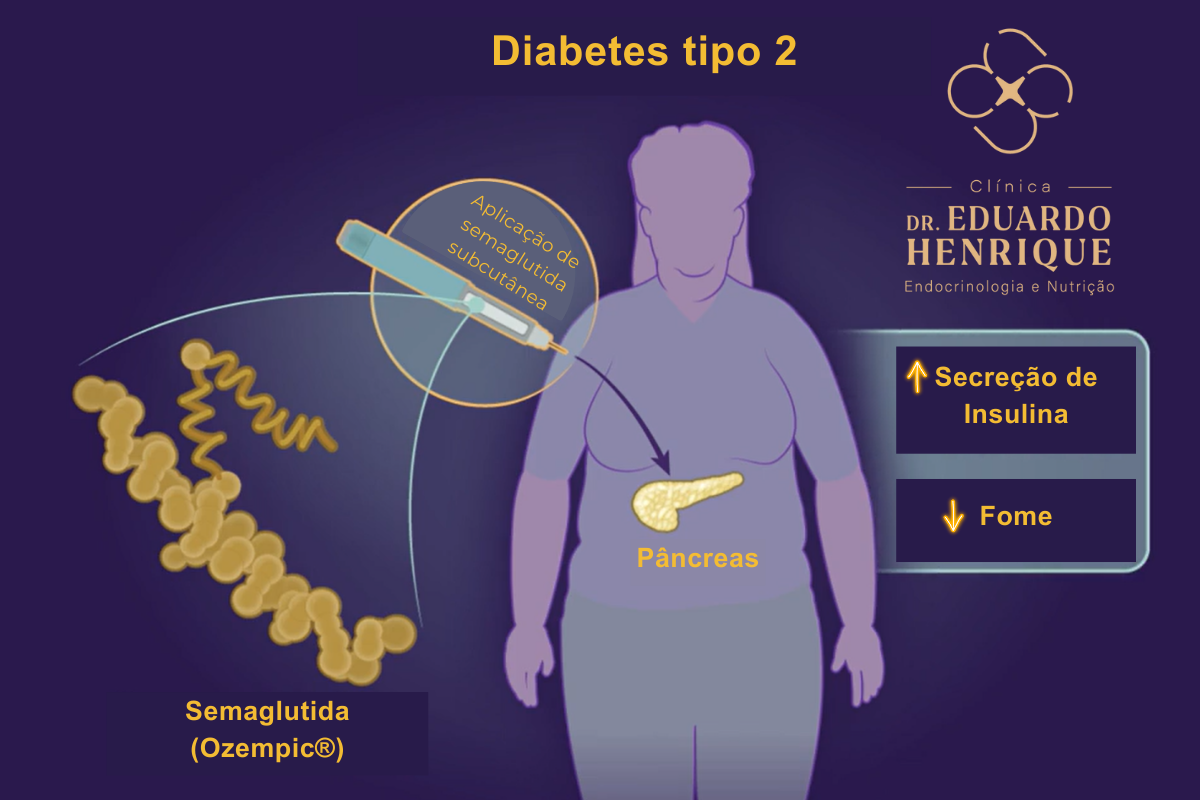 Semaglutida-diabetes-dr-eduardo-henrique-endocrinologista-sao-paulo