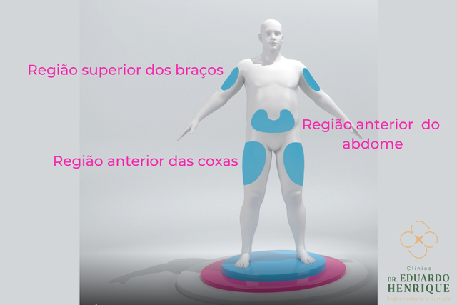 medvi zepbound Zepbound Tirzepatide Weight Loss Injections