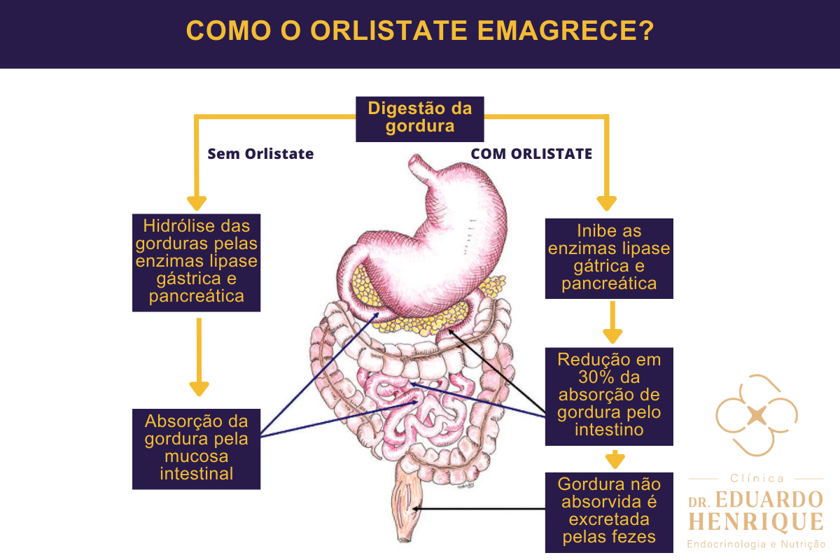 como-orlistate-emagrece-dr-eduardo-henrique-endocrinologista-sao-paulo