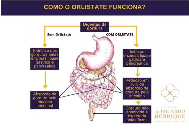 Orlistat emagrece mesmo? Veja para que serve e como tomar