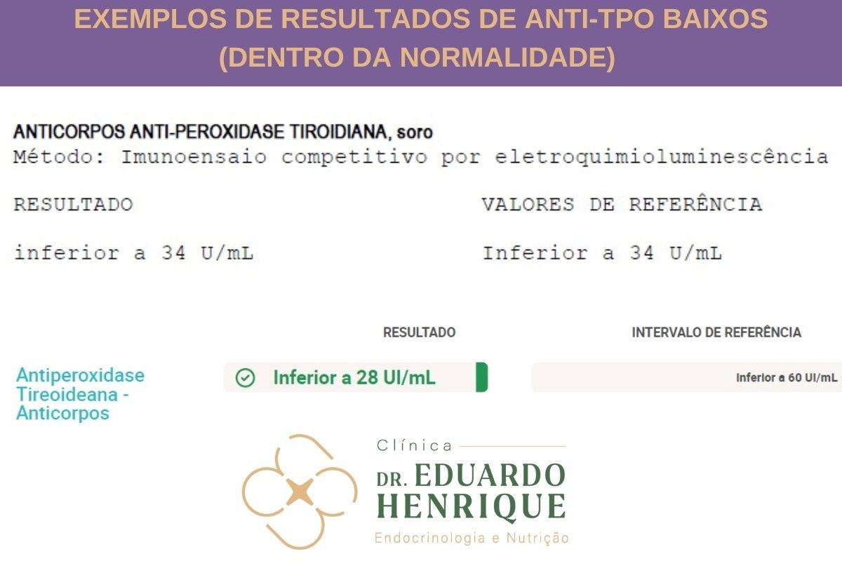resultados-anti-TPO-baixo-dr-eduardo-henrique-endocrinologista-sao-paulo