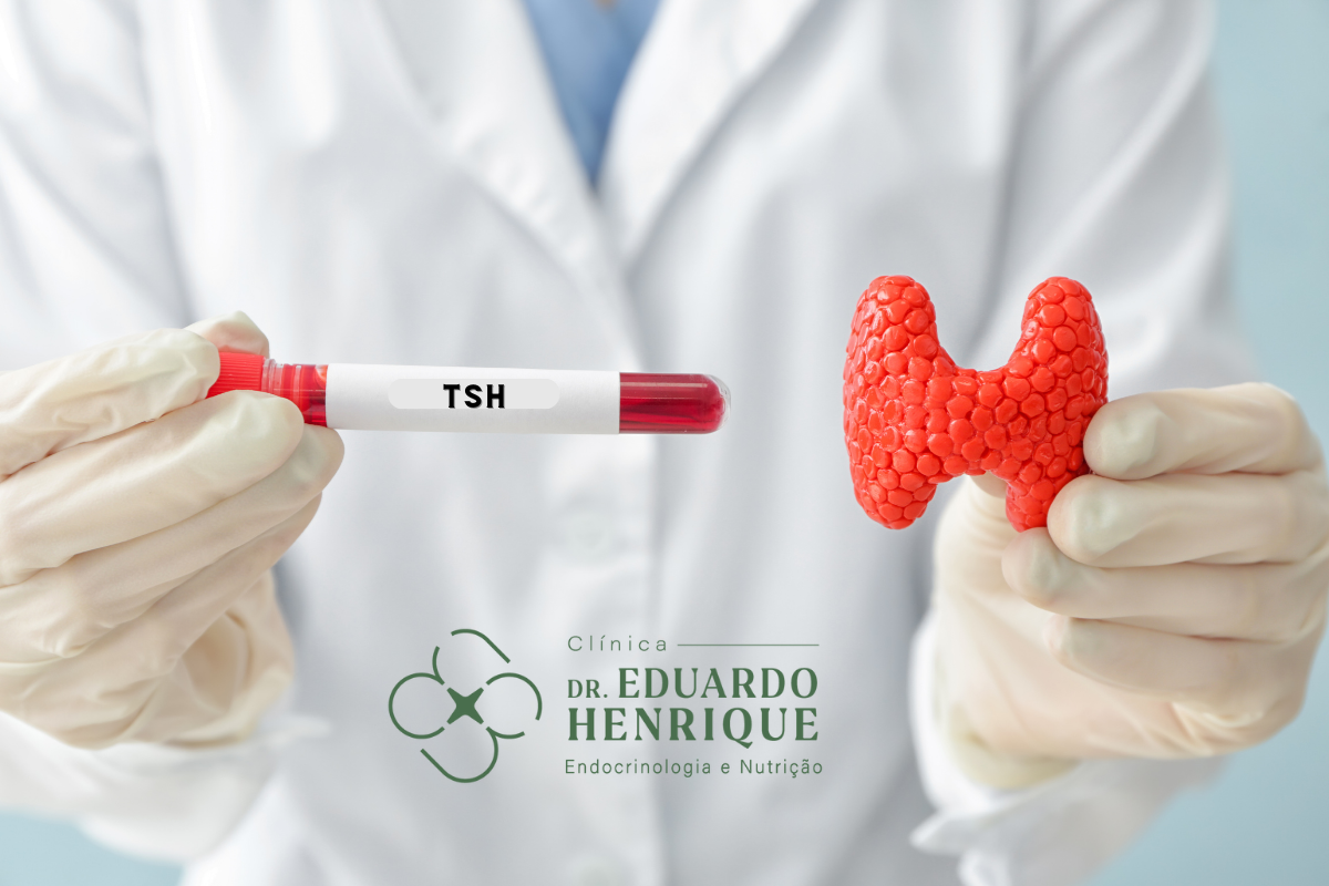 tsh-caracteristicas-dr-eduardo-henrique-endocrinologista-sao-paulo