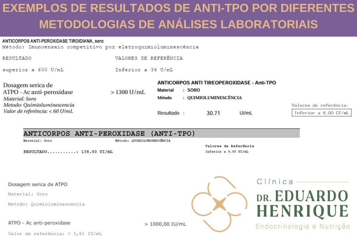 valores-anticorpos-antiperoxidase-dr-eduardo-henrique-endocrinologista-sao-paulo