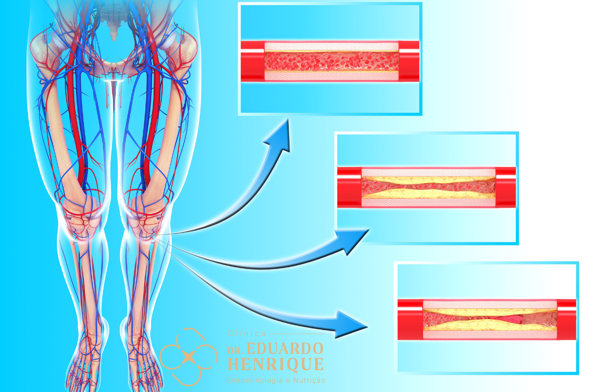 wegovy-como-funciona-dr-eduardo-henrique-endocrinologista-sao-paulo