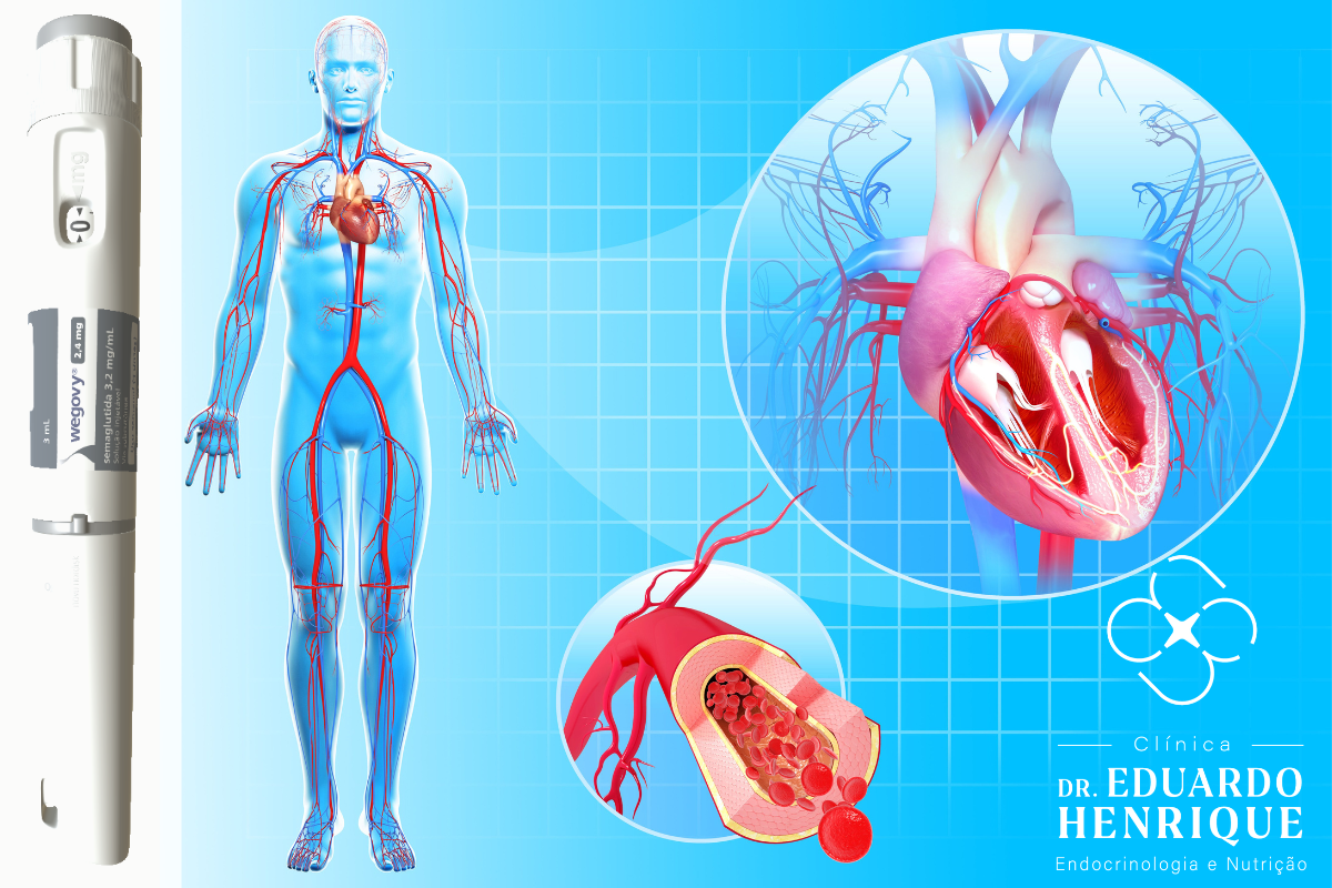 Wegovy® (Semaglutida) no Controle da Obesidade: Benefícios e Riscos do Tratamento a Longo Prazo - Dr