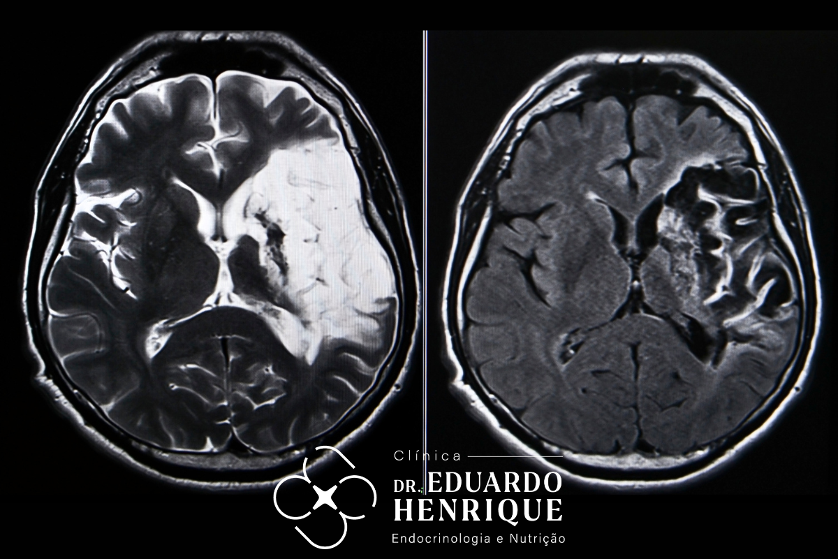 wegovy-efeitos-dr-eduardo-henrique-endocrinologista-sao-paulo