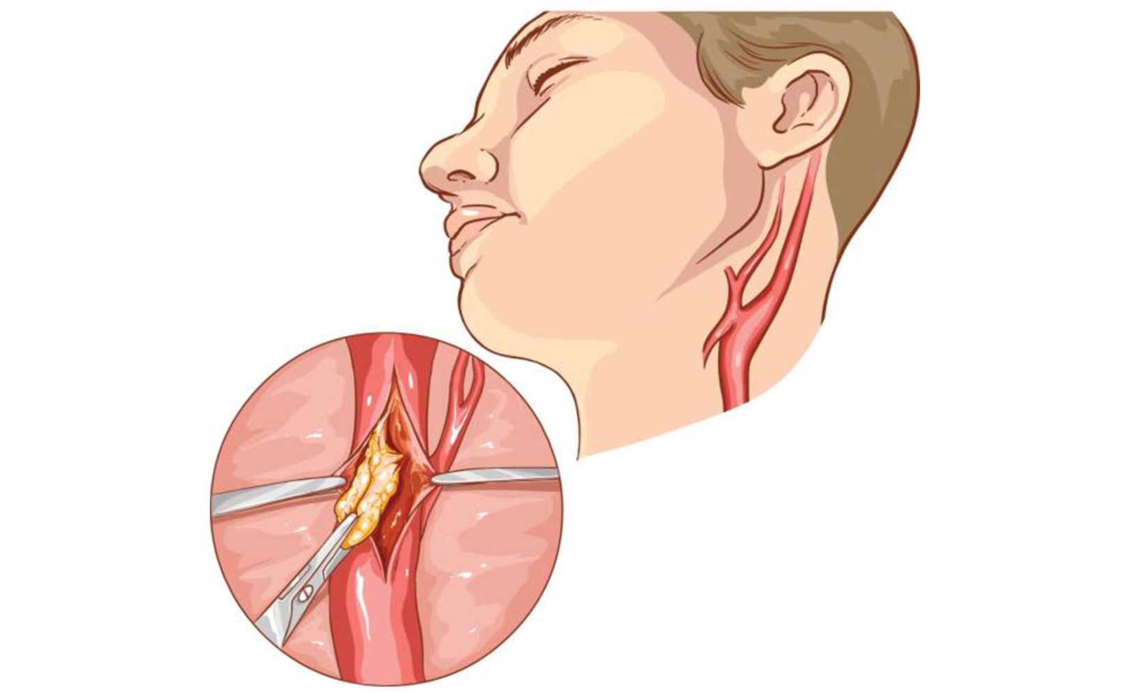 no referral vascular care tucson az