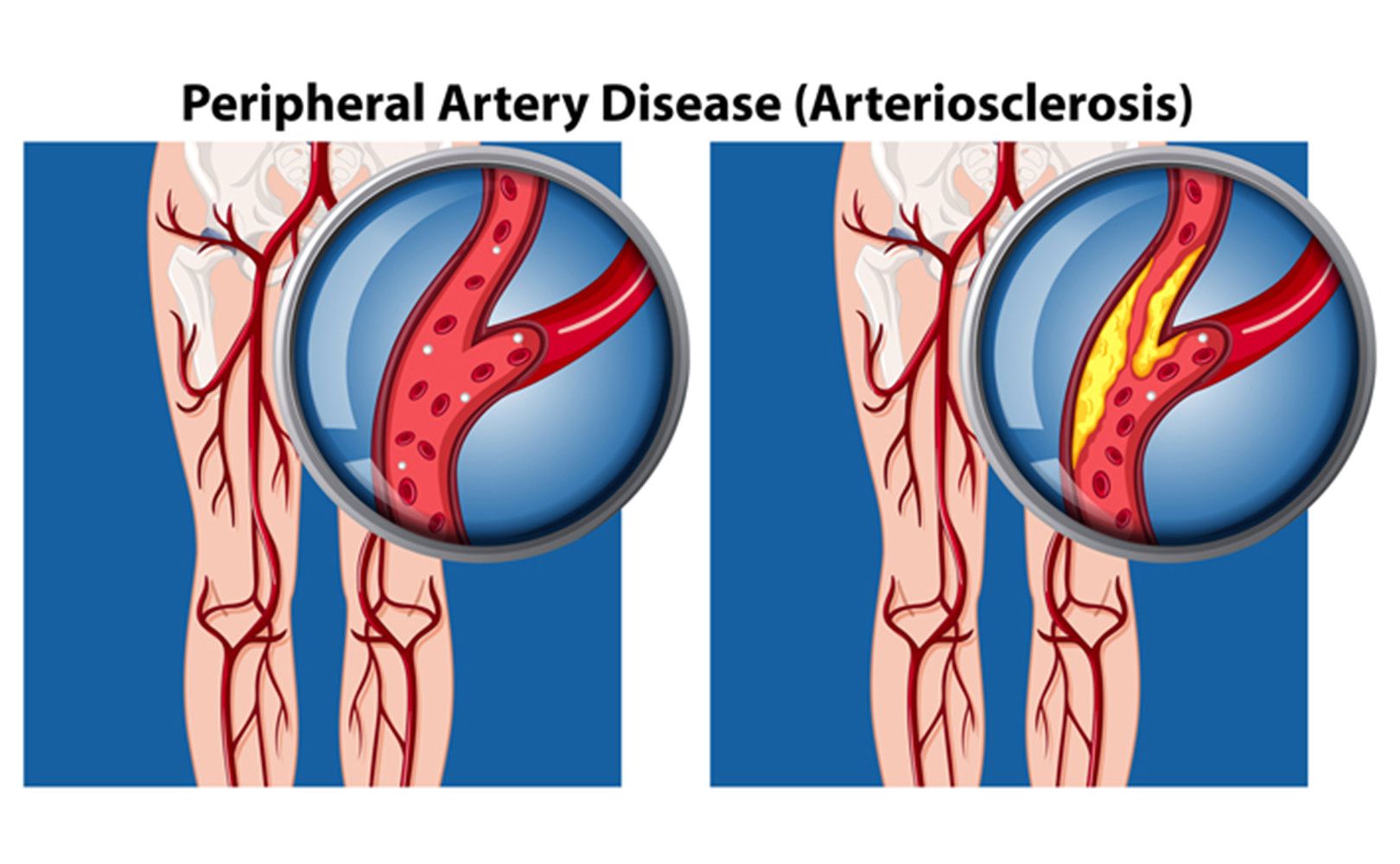 no-referral vascular care tucson az