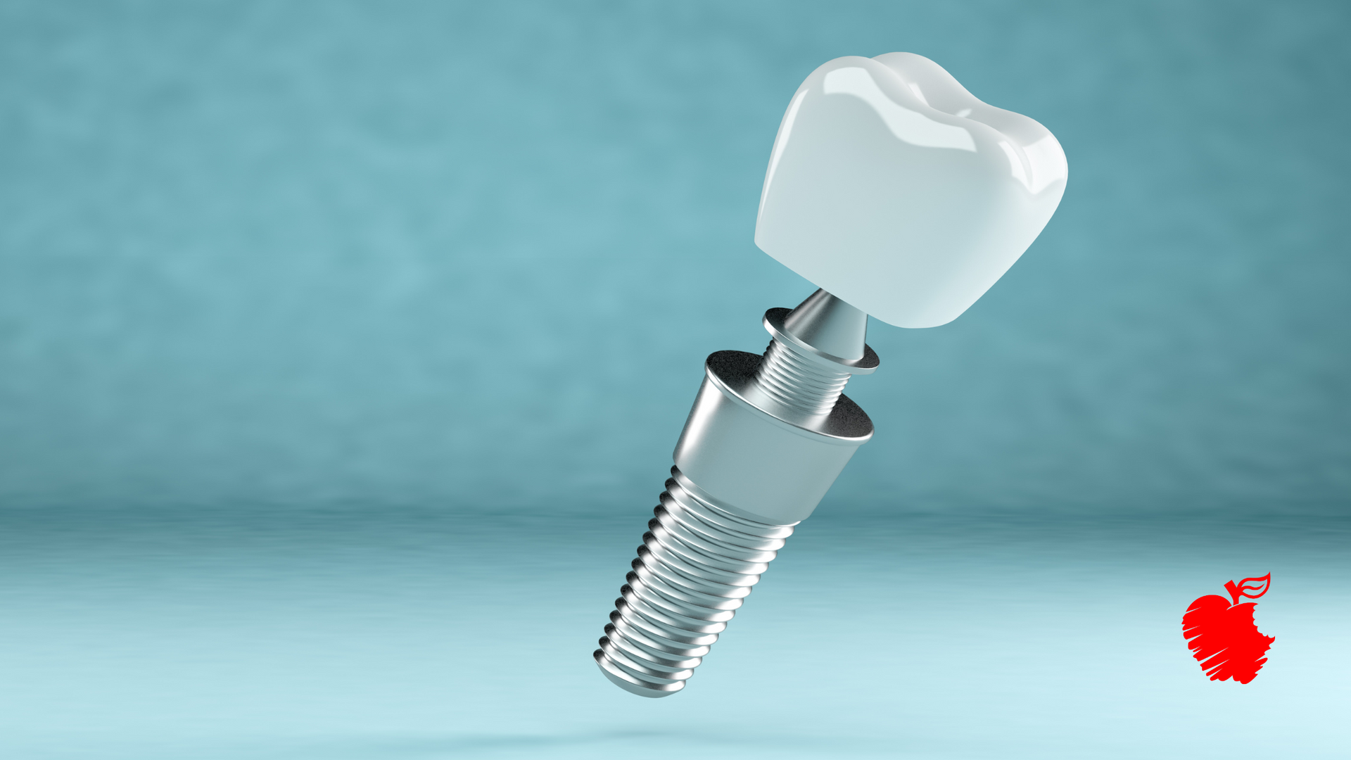 A 3d rendering of a dental implant with a tooth on top of it.