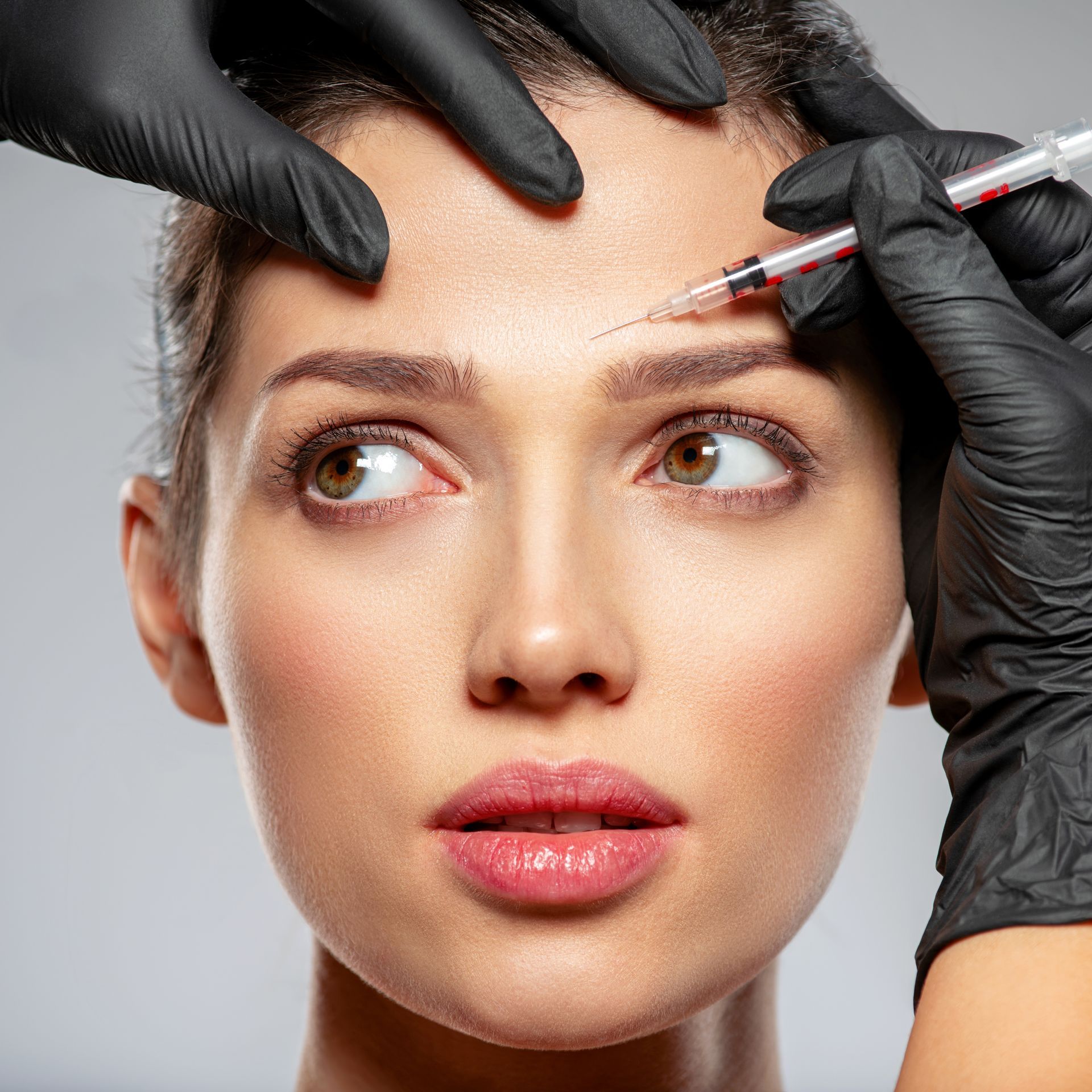 botox treatment