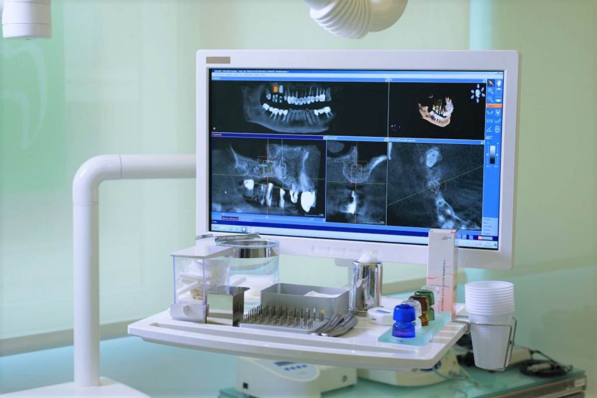radiografia della dentatura di un paziente