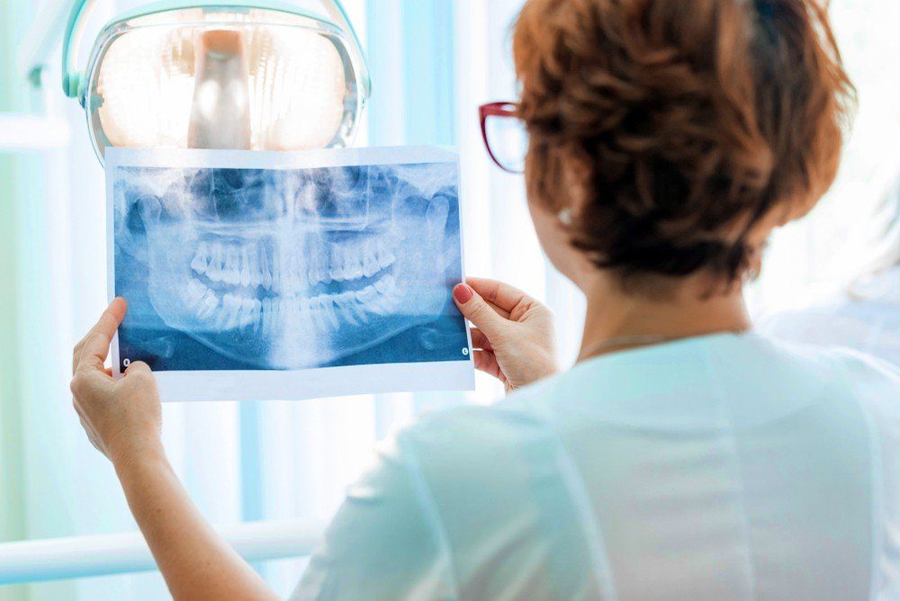 dentista che analizza radiografia dentale