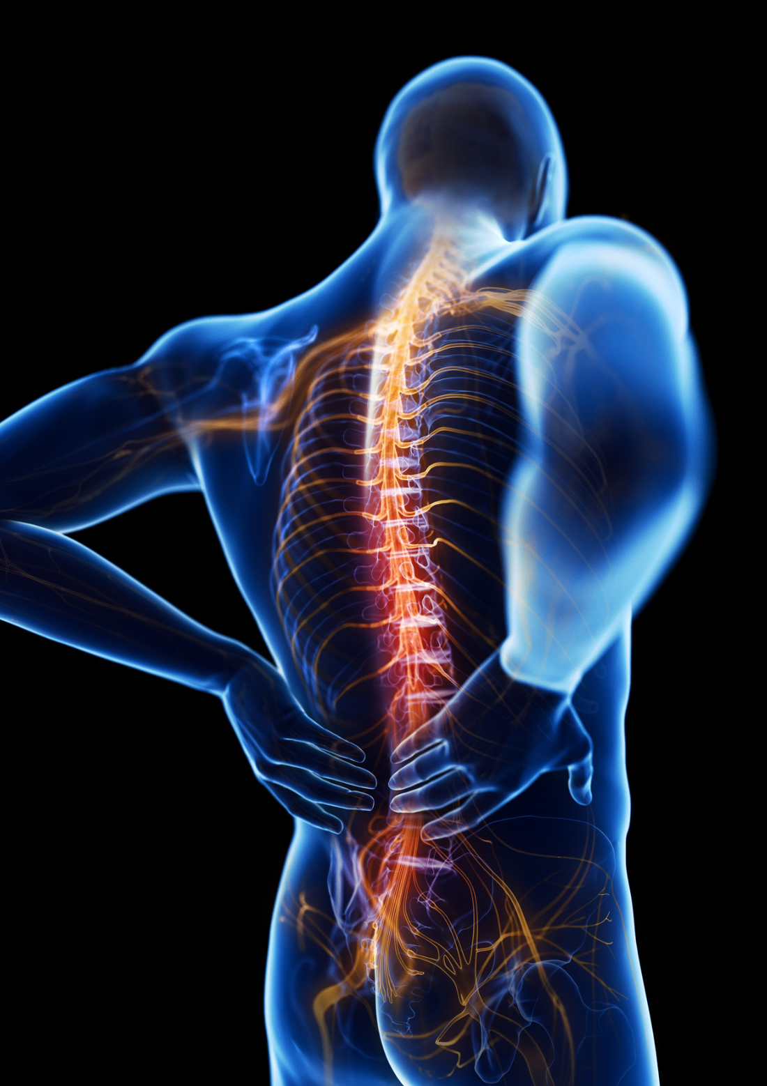 Back injury
