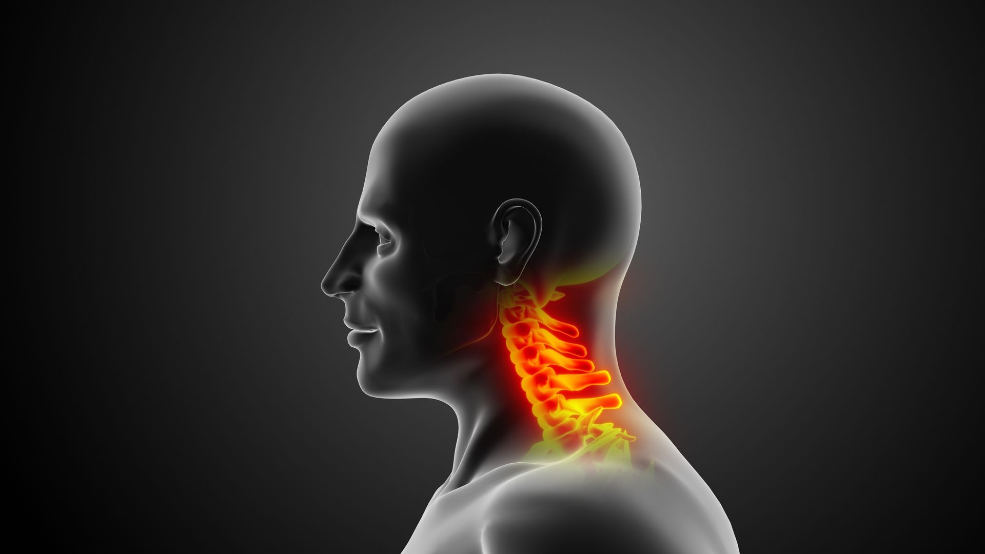 Neck and Spine Injuries