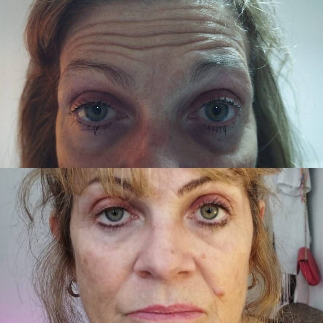 LACA BEAUTY CABALLITO