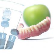 Astra Tech dental implant systems
