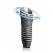 Astra Tech dental implant systems