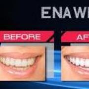 ENA White