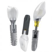 Astra Tech dental implant systems
