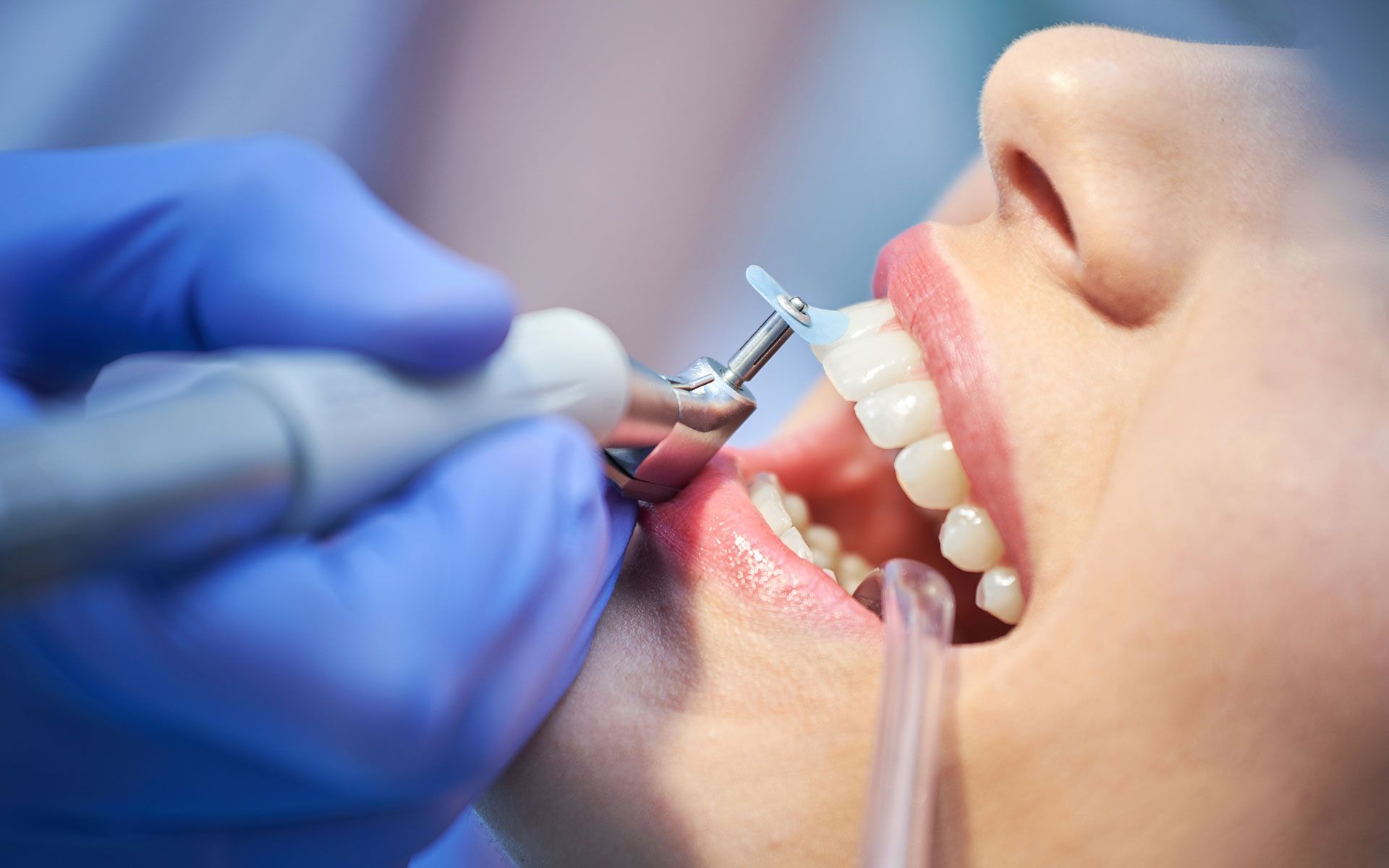 Dentist using a drill on a patient's teeth in a dental office, close-up.