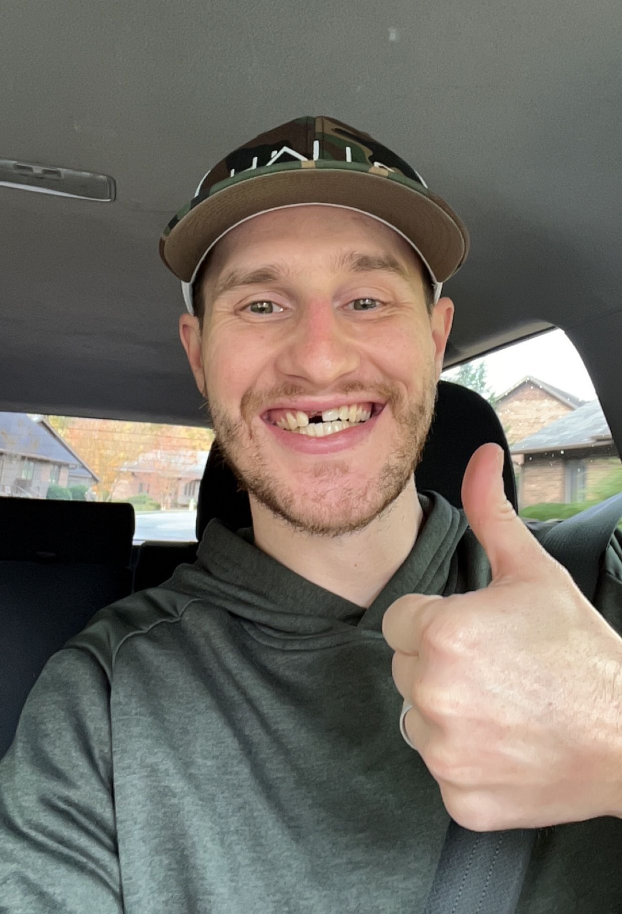 Man in a cap giving a thumbs up, missing a front tooth, smiling inside a car.