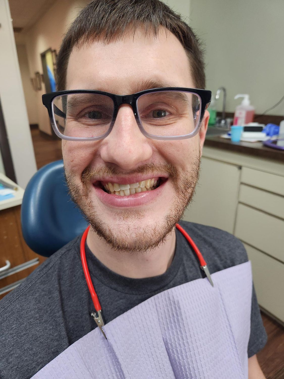 Man with glasses smiling, in a dental chair. He wears a bib, in a dental office setting.