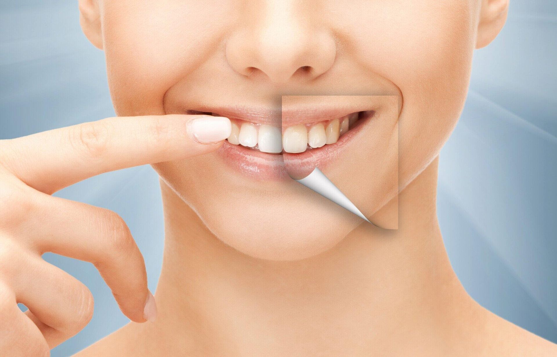 A close up of a woman 's mouth with a before and after picture of her teeth.