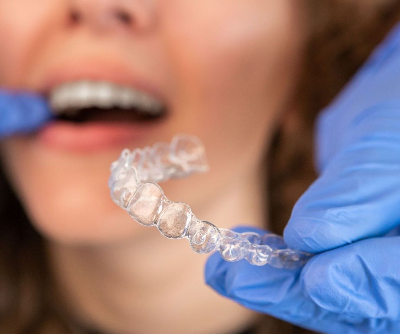 A woman is holding a clear brace in her mouth.