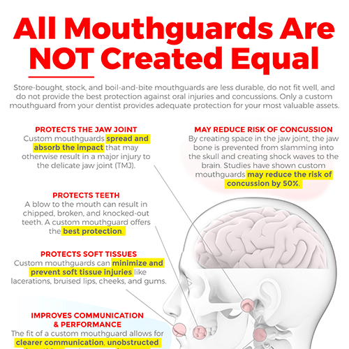 MouthGuards  Information