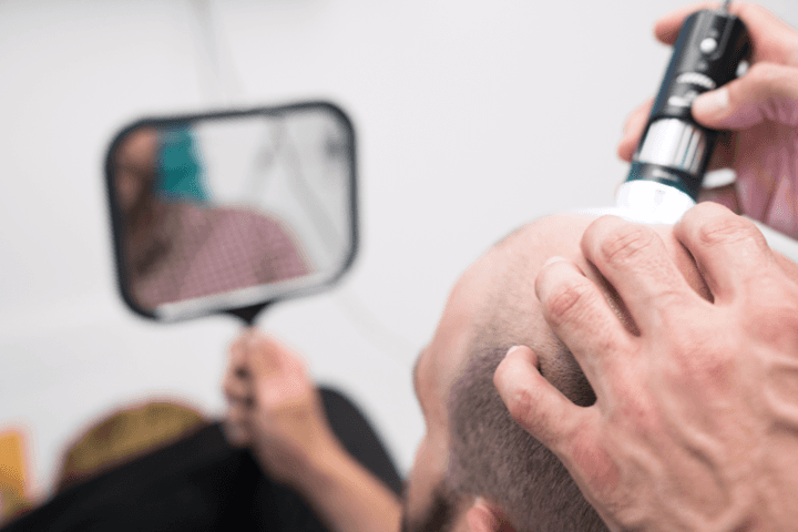 rogaine is stopping you from growing your hair
