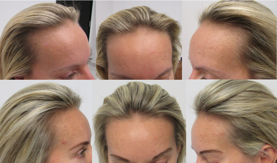 Stop and reGrow can grow and thicken naturally thin hair