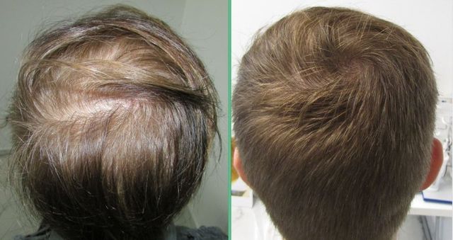 Real hair growth client success stories and reviews