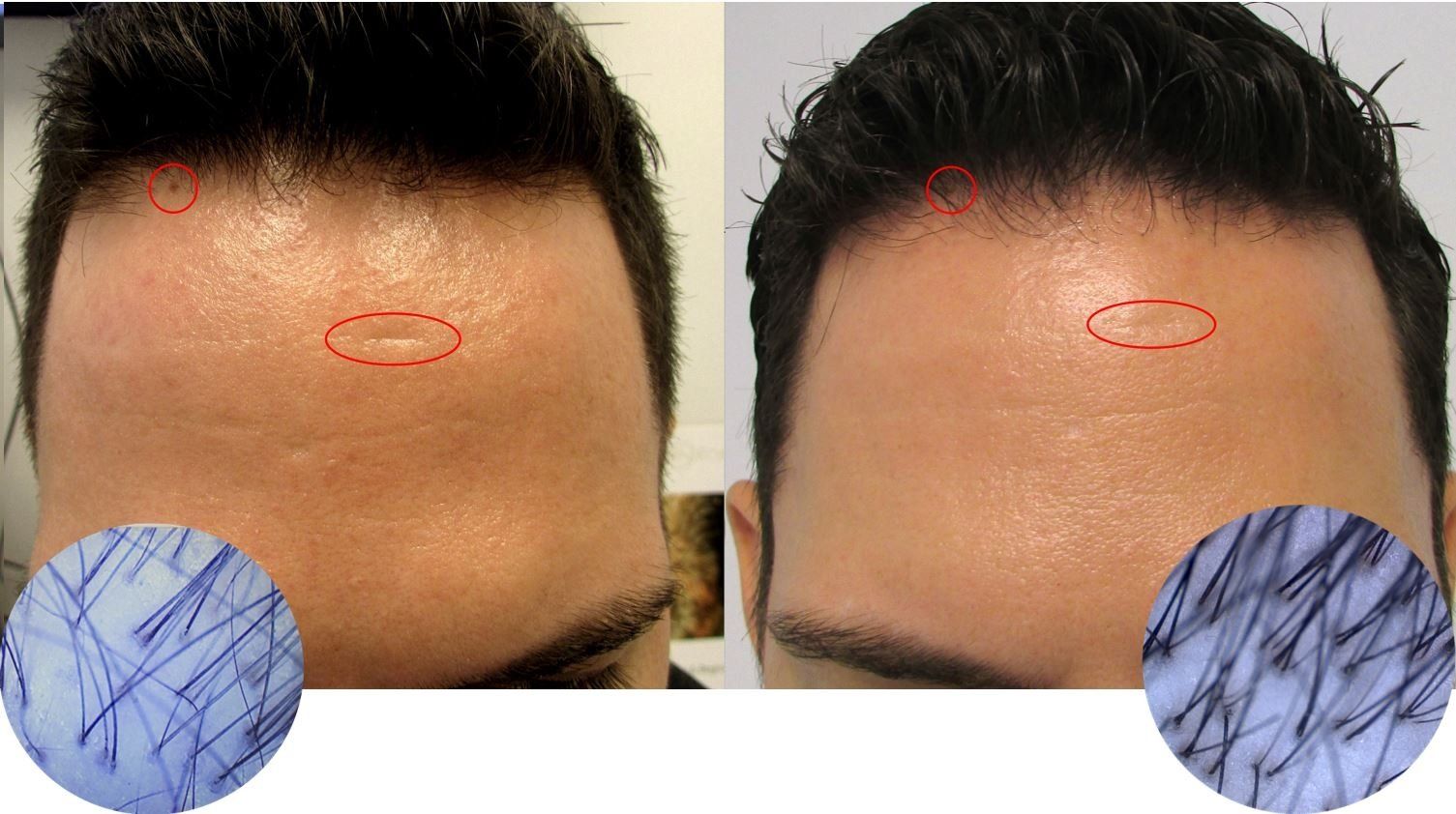 hair regrowth case study, hair growth reviews