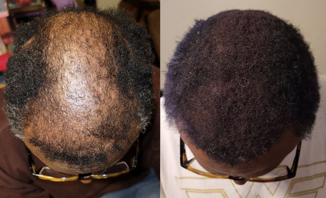 Real hair growth client success stories and reviews Real hair growth client success stories and reviews