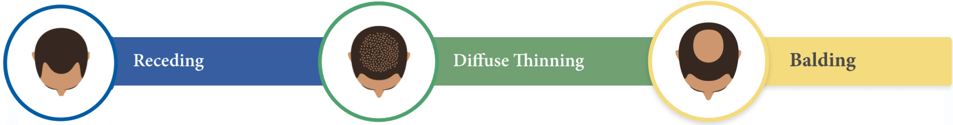 before and afters receding hair, diffuse thinning, balding hair