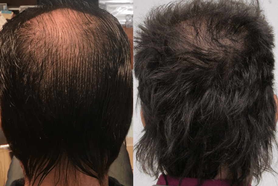 hair growth images over time customer reviews