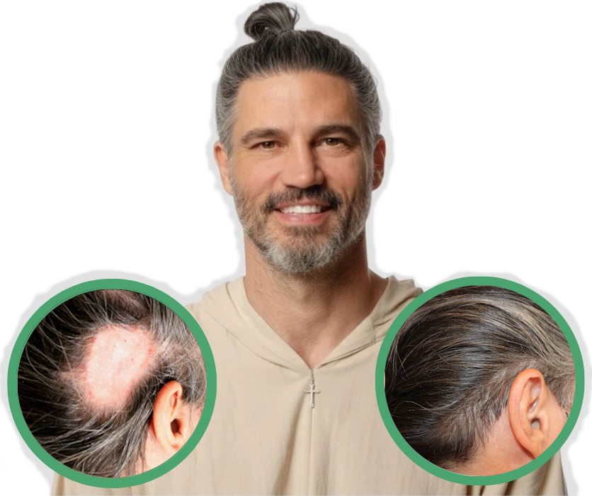 hair loss treatment for men that works every time