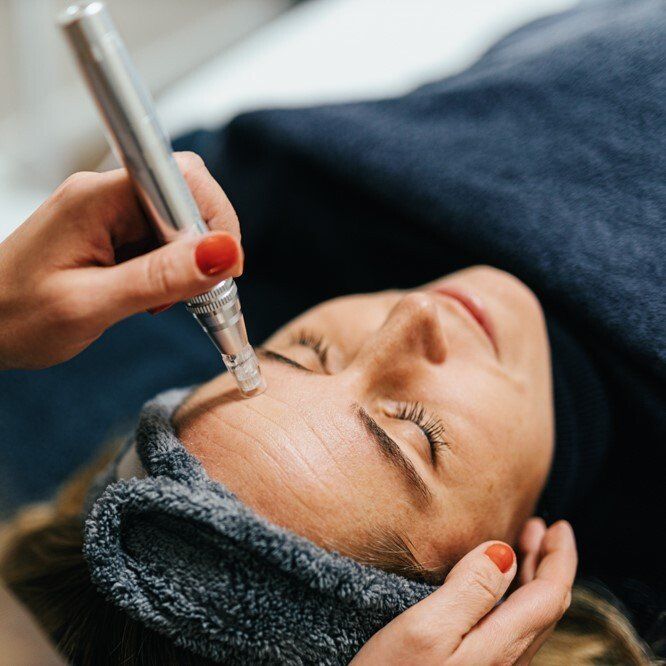 Microneedling Zürich gegen Poren, Falten /& Pigmentflecken | Dermapen Micro Needling Zurich Preise & Kosten
