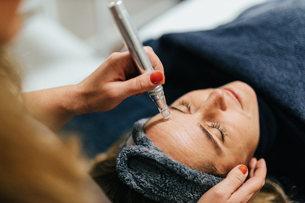 Microneedling Zürich | Microneedling Vorher-Nachher | skinra.beauty