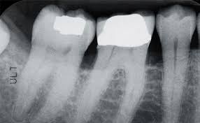  dental x-ray