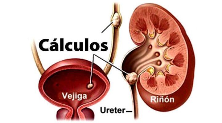 Dr. Ángel Pozos Castro