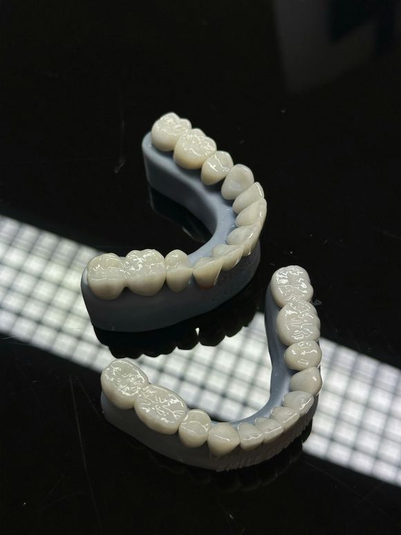 Two sets of dental molds with white teeth on gray bases, against a reflective black background.